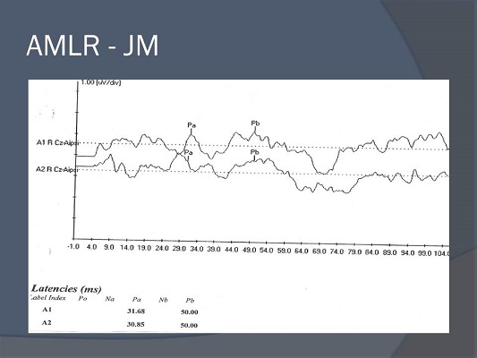 MLR of case study JM