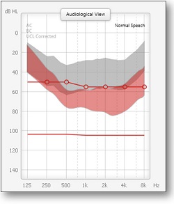 Controlling for upward spread of masking
