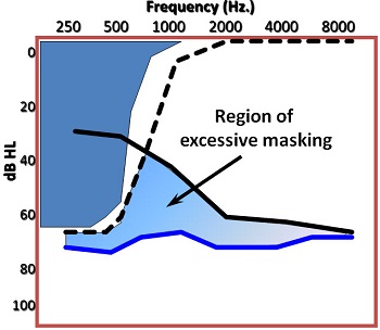 Measuring excessive masking in an individual with sensorineural hearing loss