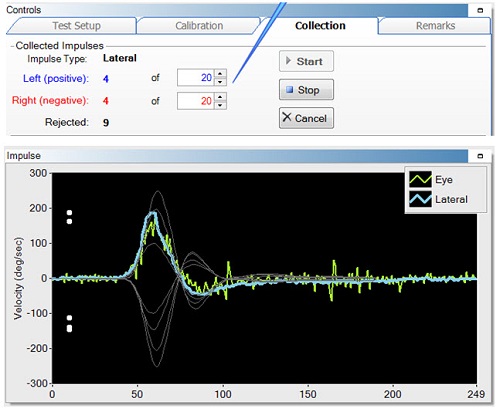 Collection tab indicating the accepted responses and rejections and the training curves to match the recorded responses