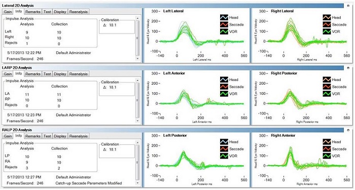 Analysis algorithms for lateral, LARP and RALP measurements