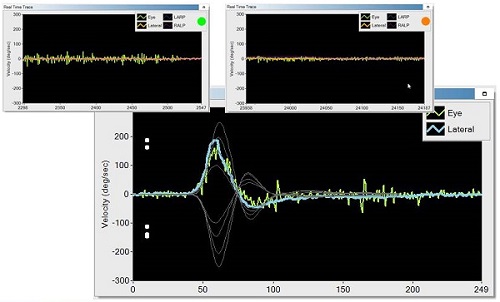 Training curves and operator feedback