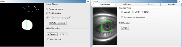 Region of interest box and pupil detection box