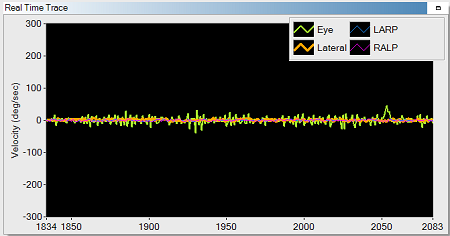Real time trace of video recording