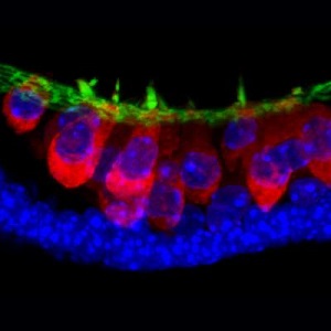 stem-cell-derived sensory hair cells with hair bundles