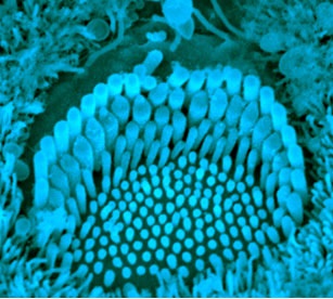 Scanning electron microscopy image of a sensory cell of the mouse inner ear