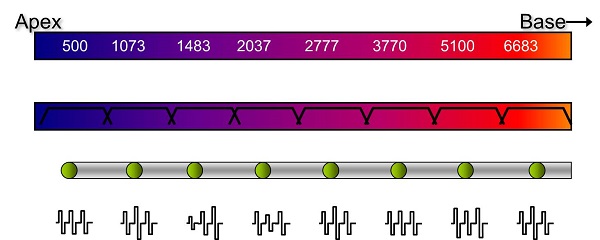 Schematic of a conventional cochlear implant array from apex to base