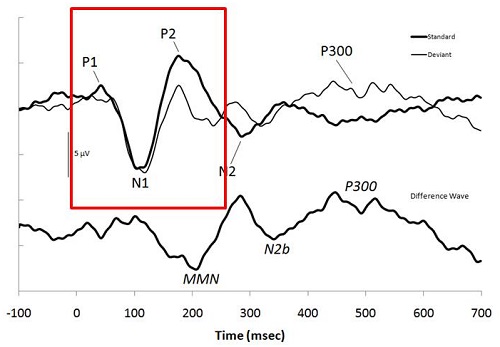 Example of a CAEP and the associated markers