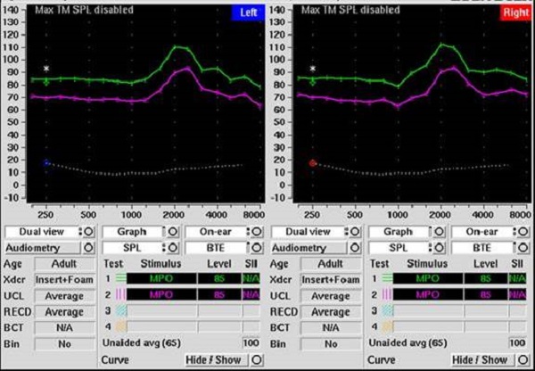 Verification of well-fitted flat attenuation earplugs