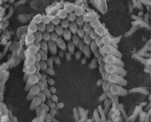 molecular makeup of the hair cell transduction channel