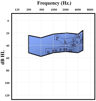 Audiogram comparing unvoiced plosives, voiceless fricatives and second-formant vowels