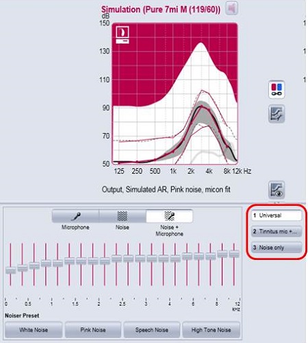 TAT settings in a Simens micon hearing aid for a patient with hearing loss