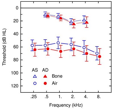 Average pure-tone thresholds with interindividual standard deviations for 19 subjects