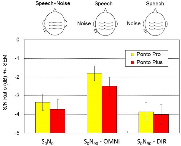 Speech-in-noise results in sound field for Ponto Pro and Ponto Plus