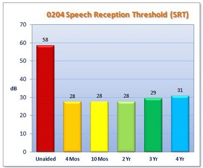 IDE clinical trial results for SRT. Measurements were taken at 1 month, 4 months, 10 months, 2 years, 3 years, and 4 years