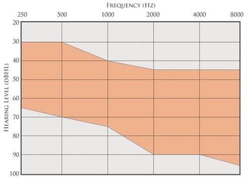 Ideal fitting range for Esteem of audiometric thresholds that are most likely to achieve prescriptive gain targets