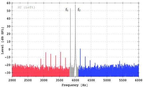 Tartini tones then, distortion product otoacoustic emissions now, recorded from a young healthy ear
