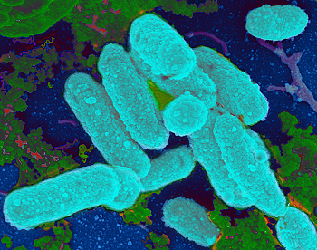 Haemophilus influenzae bacteria attaching to a surface as seen by a scanning electron microscope