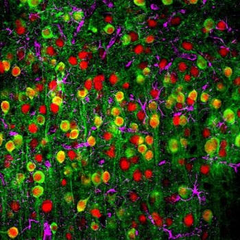 This is a two-photon microscopy image showing a calcium sensor, the nuclei of neurons and supporting cells called astrocytes