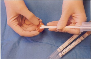 Specimen collection swabs and collection procedure