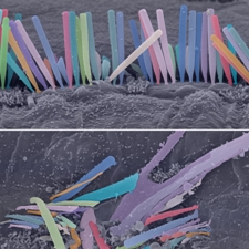 Scanning electron microscopy of inner hair cells from cochleas of wild type and mutant mice