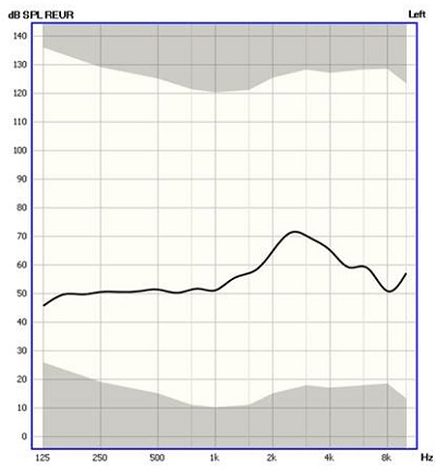The REUR showing the natural ear canal resonance between 2000 and 4000 Hz