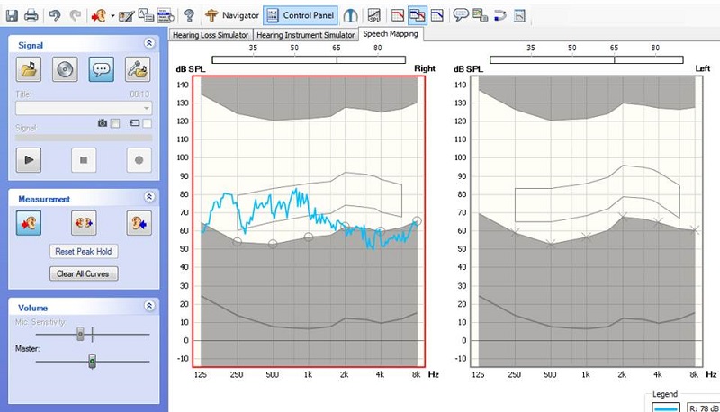 Screen shot of FitAssist speech mapping