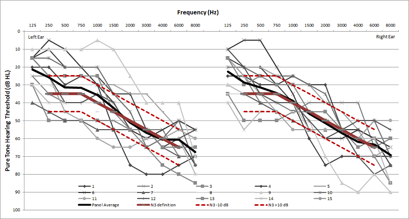 Pure tone audiograms for the hearing impaired listening panel