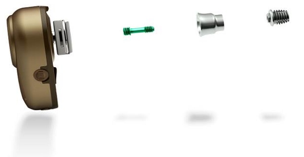 Ponto percutaneous bone anchored hearing system