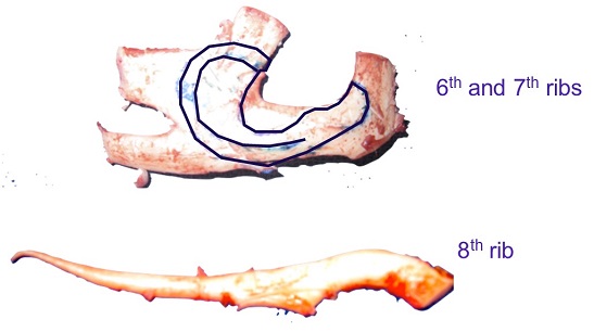 Framework as to how the cartilage will be used for the ear