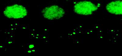 Immunostained mouse auditory nerve synapses after noise exposure