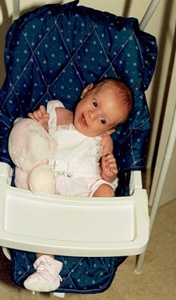 Vestibular dysfunction causing an infant&rsquo;s head to fall to the side