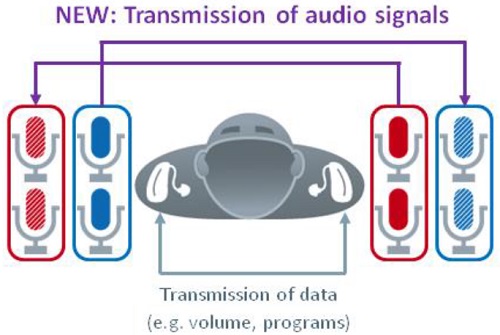 e2e wireless 3.0 is able to link the microphones in both hearing instruments in a bilateral fitting