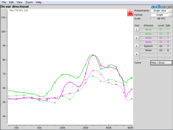On-ear results of a RIC with an open dome