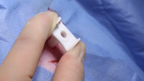 MIPS step-by-step video