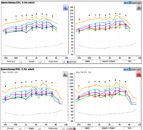 Results from Verifit 2 for a BTE hearing aid. Test box verification and on-ear verification