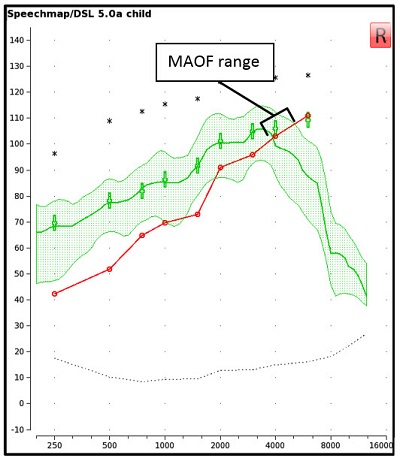 An Audioscan Verifit display of the hearing threshold line with the aided LTASS
