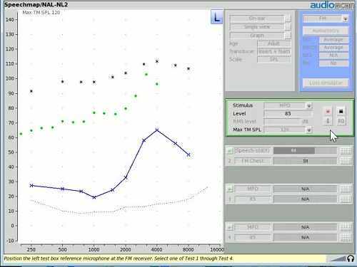 Screenshot of Video 4 demonstrating the initial RESR response with MPO selected as the test condition