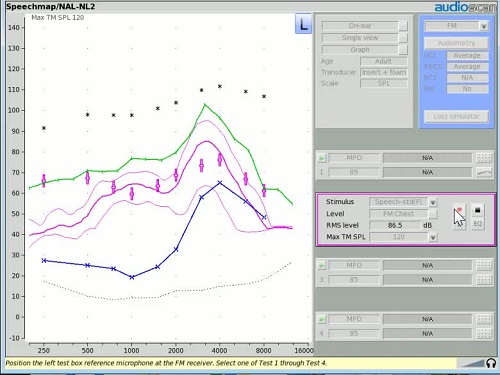 Screenshot of Video 5 where test 2 is activated and the FM Chest input level is selected
