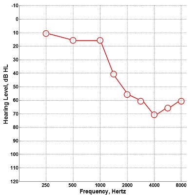 Audiogram entered into the Starkey Inspire programming software that was used to evaluate the effects of Spectral iQ