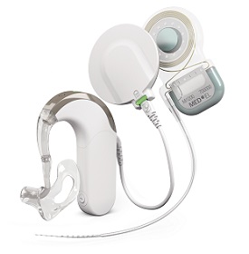 SYNCHRONY EAS Hearing Implant System