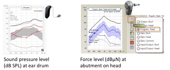 SPLogram for hearing aids and FLogram for bone anchored fittings