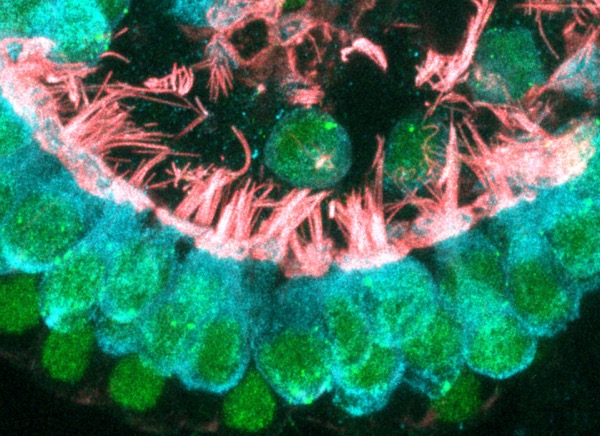Newly formed cochlear hair cells