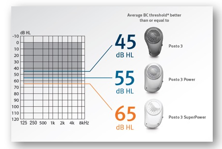 Ponto 3 family fitting range