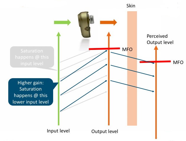 Case from Figure 6 is applied on a Softband solution