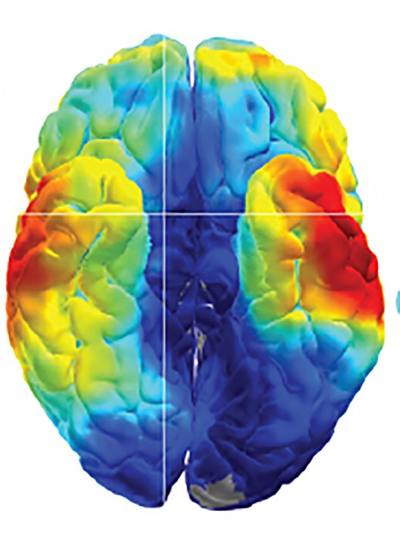 Scientists at NIH used electrical recordings to study how the human brain remembers