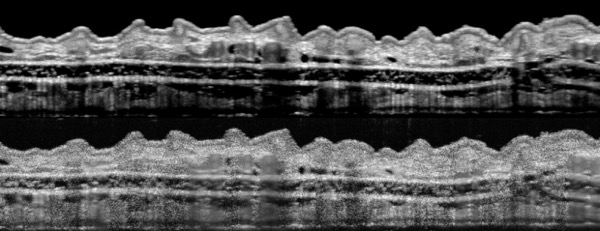 section of a mouse’s outer ear
