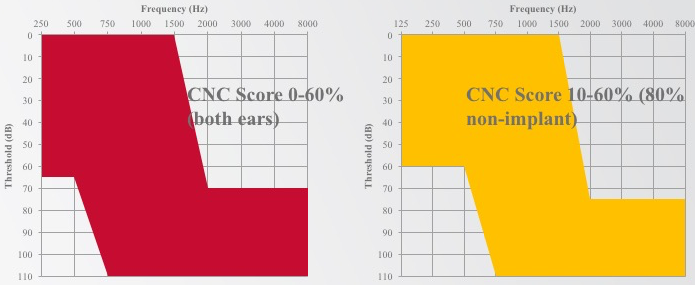 Candidacy audiograms