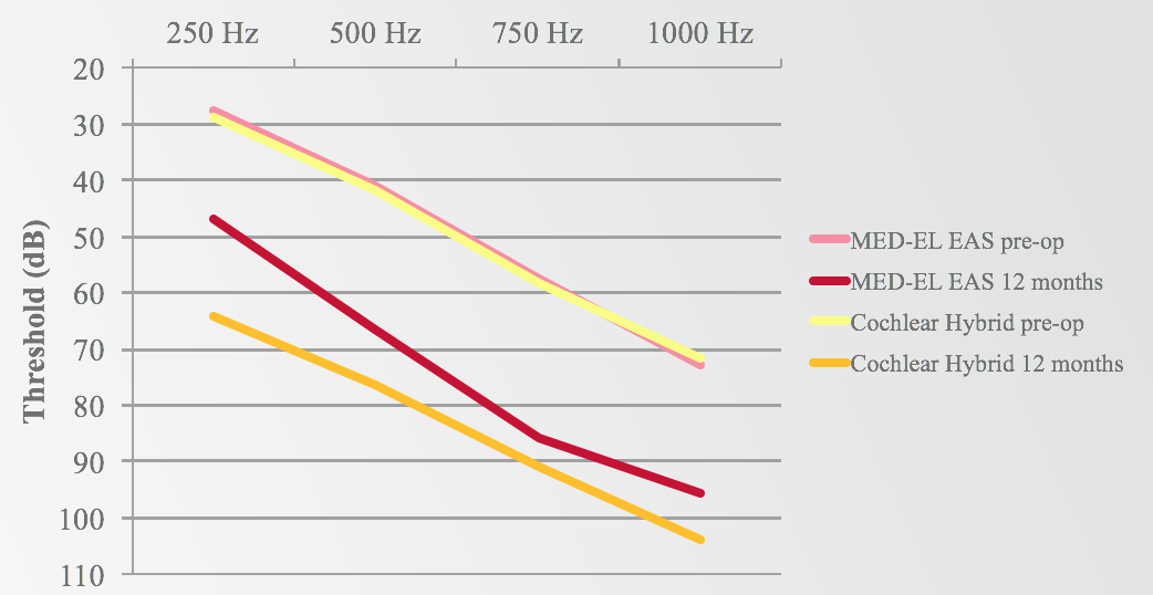 MED-EL EAS versus Cochlear Hybrid. low-frequency shift