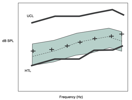 Audiogram of gently sloping loss